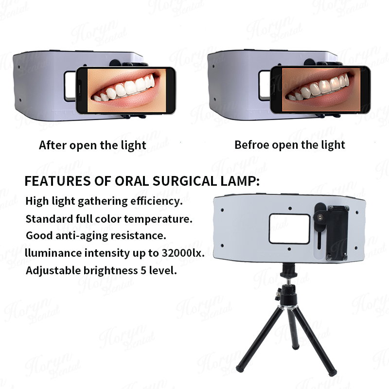 Dental Flash Light Photography - Photography Lighting Led บทวิจารณ์และราคา